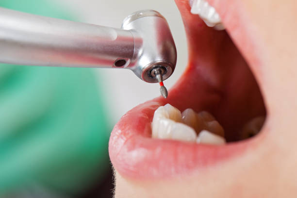 Best Emergency Gum Treatment in Jennings, LA
